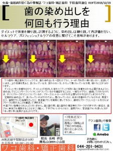 わ　ワコ歯科・矯正歯科通信　019　は　歯の染め出しを何回も行う理由　2015-1215-001